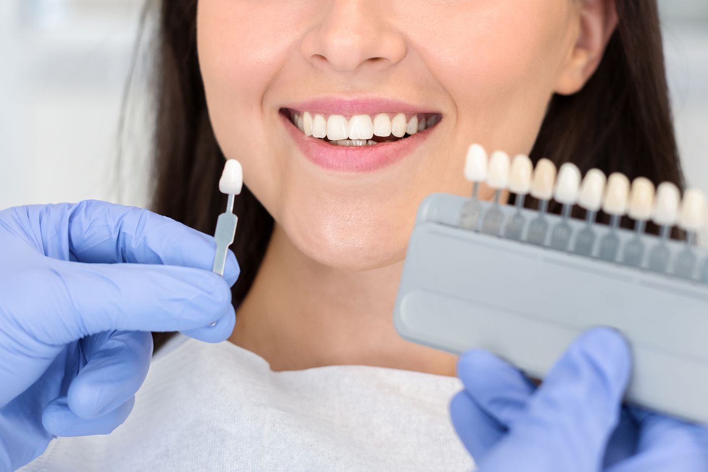 Dentist holding shade guide and swab near patient's smile