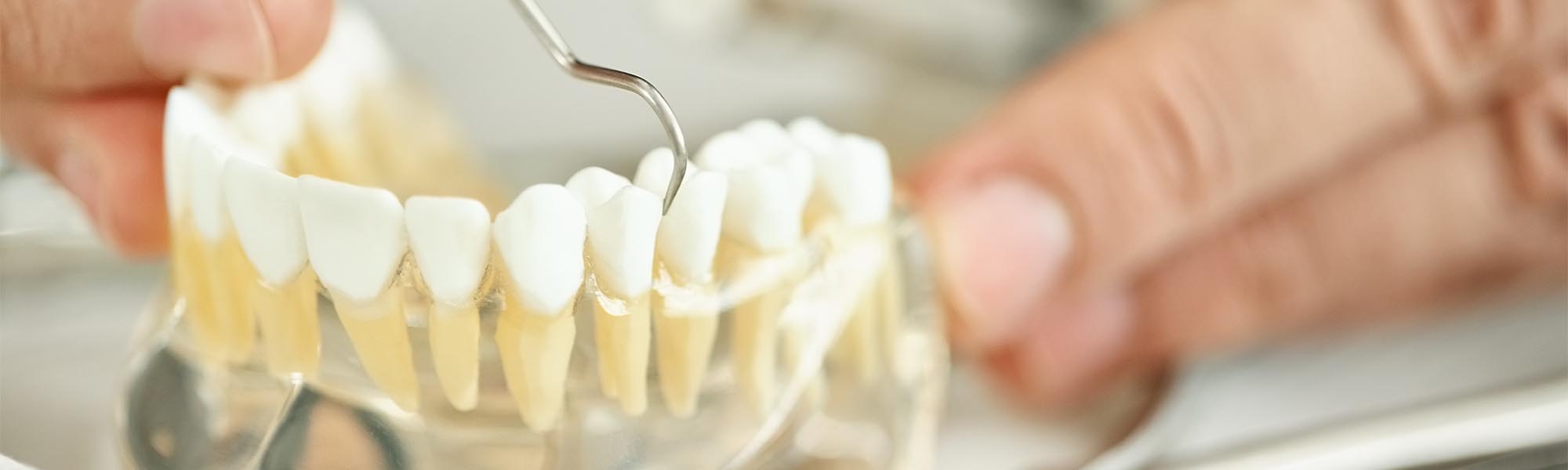 Restorative Dental Treatments Dentist Torrance CA