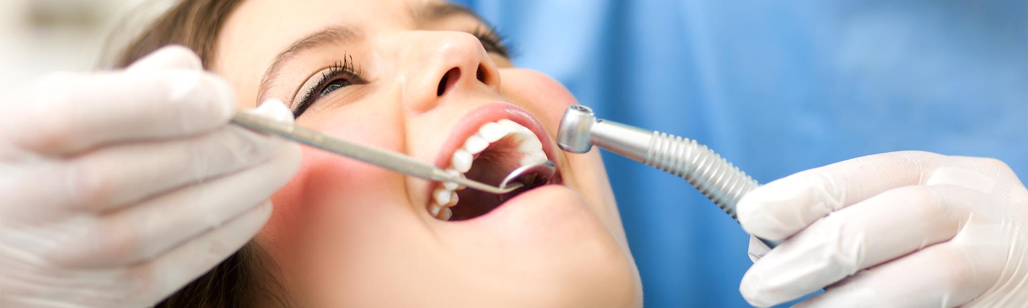 Routine Teeth Cleaning in Torrance CA